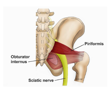 Piriformis Syndrome – Diversified Integrated Sports Clinic