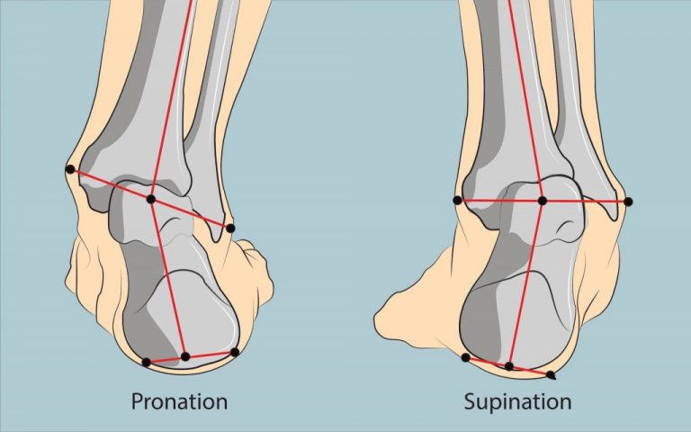 Pronation Vs. Supination – Diversified Integrated Sports Clinic