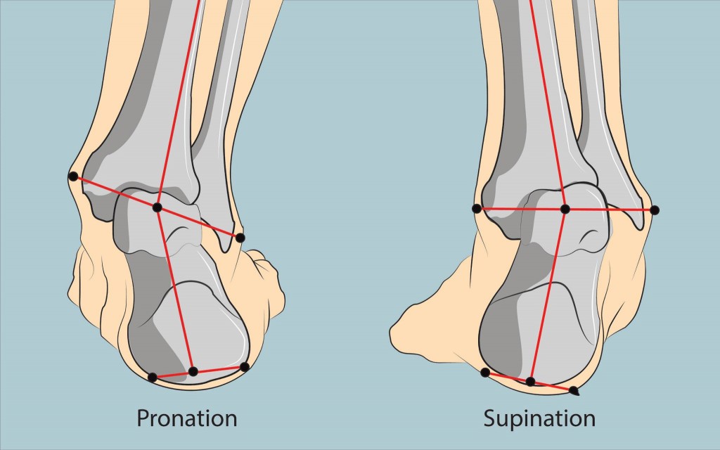 How To Correct Supination - Supination Exercises 
