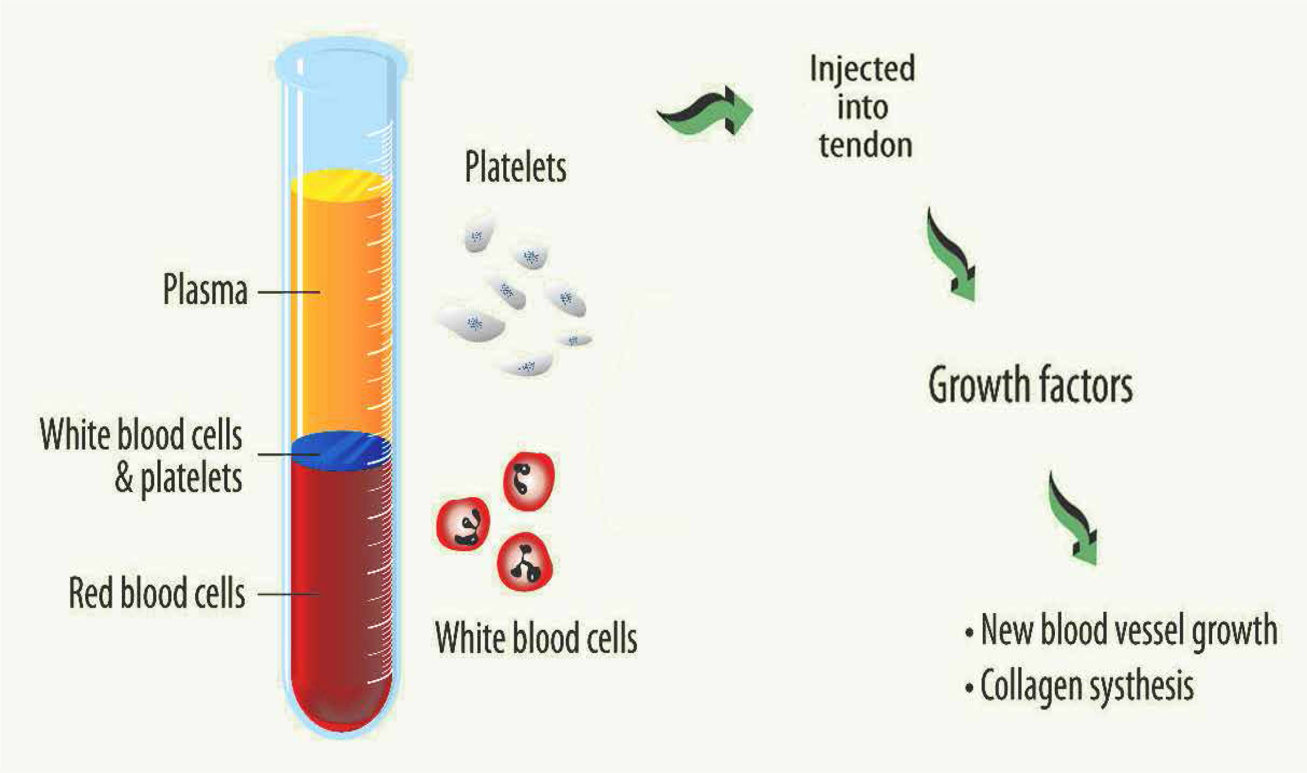 platelet-rich-plasma-prp-therapy-diversified-integrated-sports