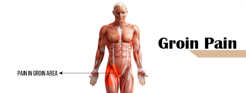 Groin Pain. Structures and conditions that can contribute to groin